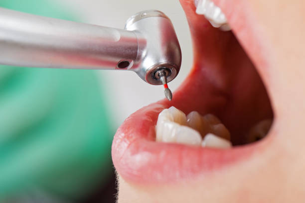 Best Emergency Dental Surgery in Mcchord Af, WA